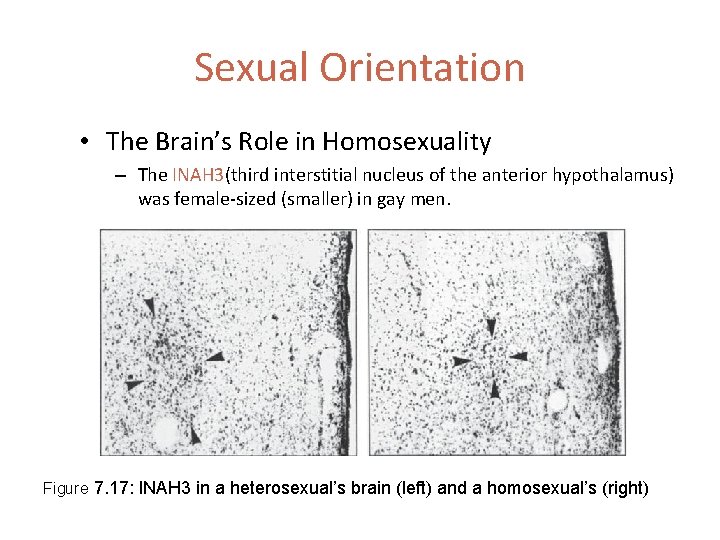 Sexual Orientation • The Brain’s Role in Homosexuality – The INAH 3(third interstitial nucleus