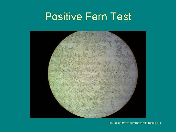 Positive Fern Test Retrieved from: commons. wikimedia. org 