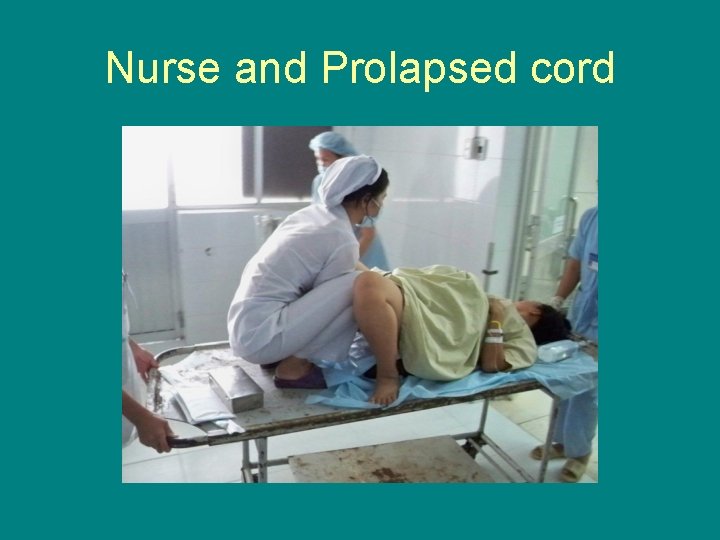 Nurse and Prolapsed cord 