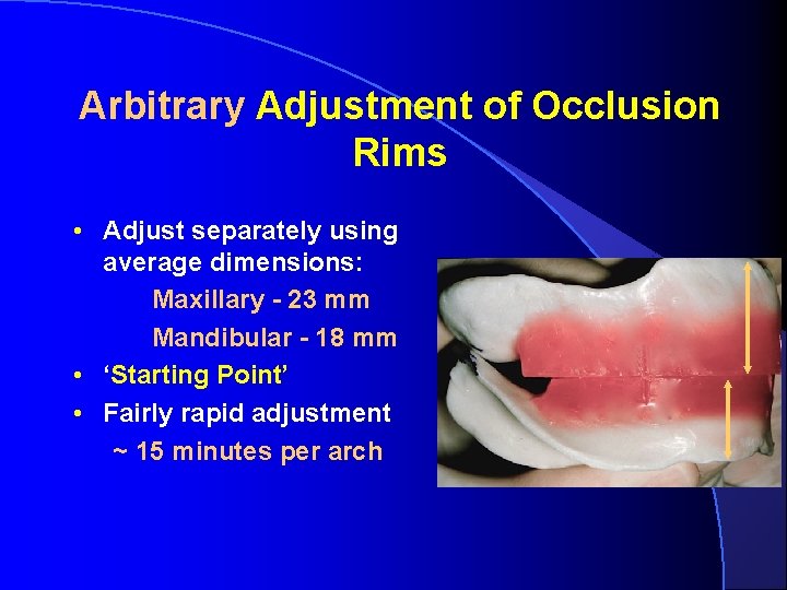 Arbitrary Adjustment of Occlusion Rims • Adjust separately using average dimensions: Maxillary - 23