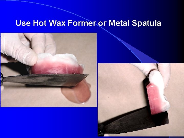 Use Hot Wax Former or Metal Spatula 