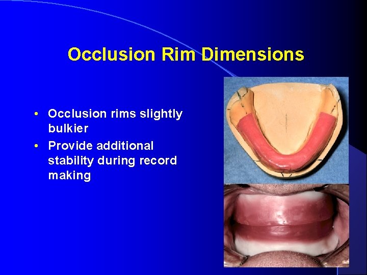 Occlusion Rim Dimensions • Occlusion rims slightly bulkier • Provide additional stability during record