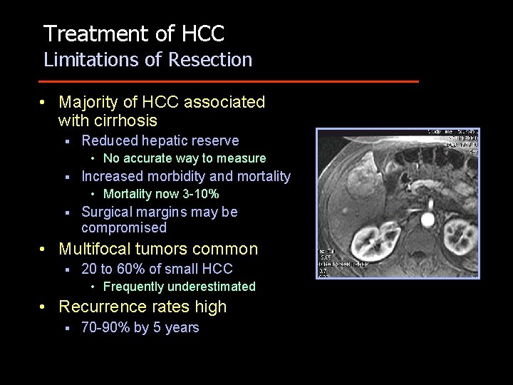 Treatment of HCC Limitations of Resection • Majority of HCC associated with cirrhosis §