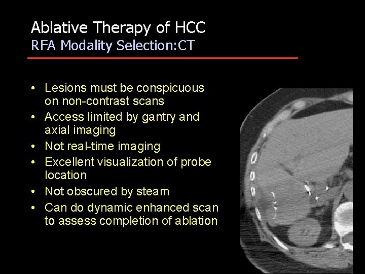 Ablative Therapy of HCC RFA Modality Selection: CT • Lesions must be conspicuous on