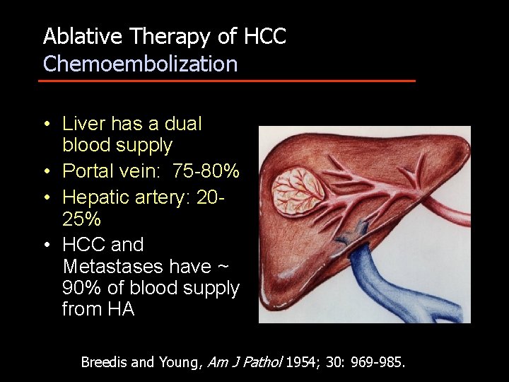 Ablative Therapy of HCC Chemoembolization • Liver has a dual blood supply • Portal
