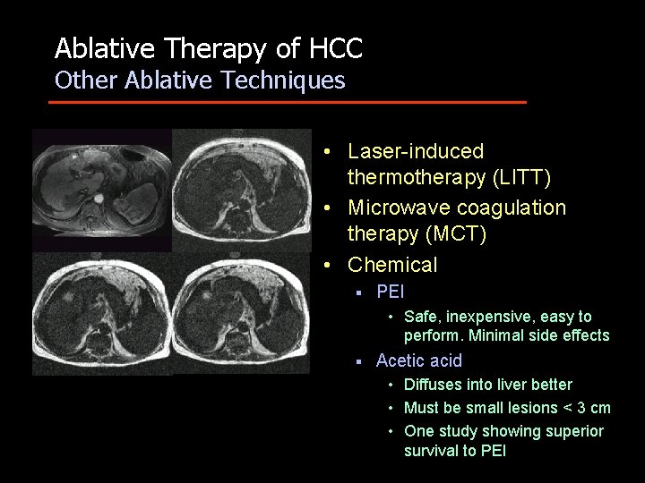 Ablative Therapy of HCC Other Ablative Techniques • Laser-induced thermotherapy (LITT) • Microwave coagulation
