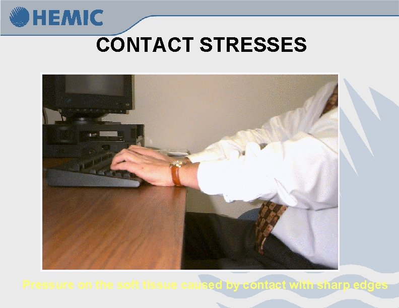 CONTACT STRESSES Pressure on the soft tissue caused by contact with sharp edges 