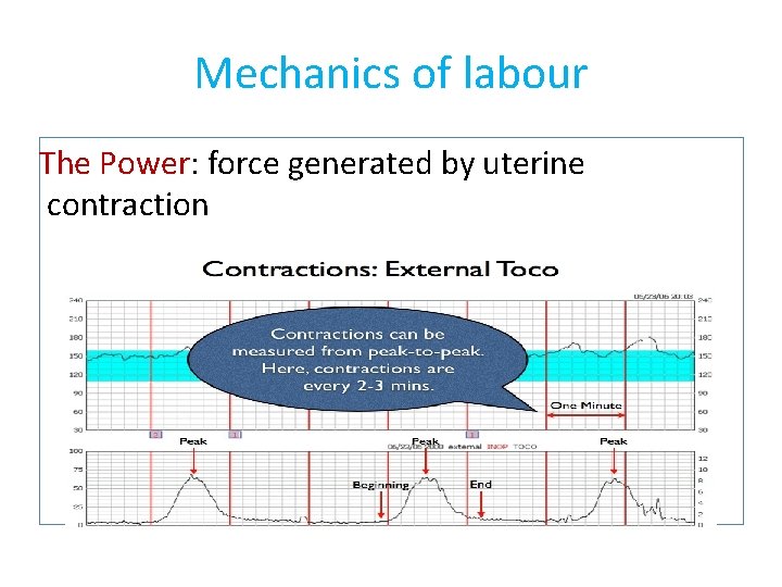 Mechanics of labour The Power: force generated by uterine contraction 