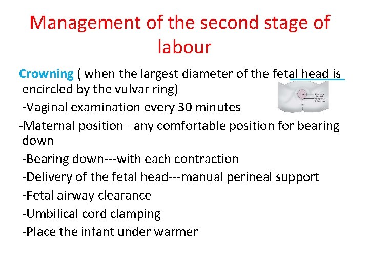 Management of the second stage of labour Crowning ( when the largest diameter of