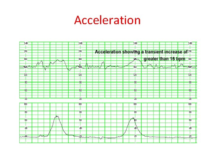 Acceleration 