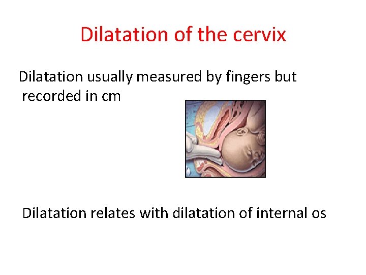 Dilatation of the cervix Dilatation usually measured by fingers but recorded in cm Dilatation