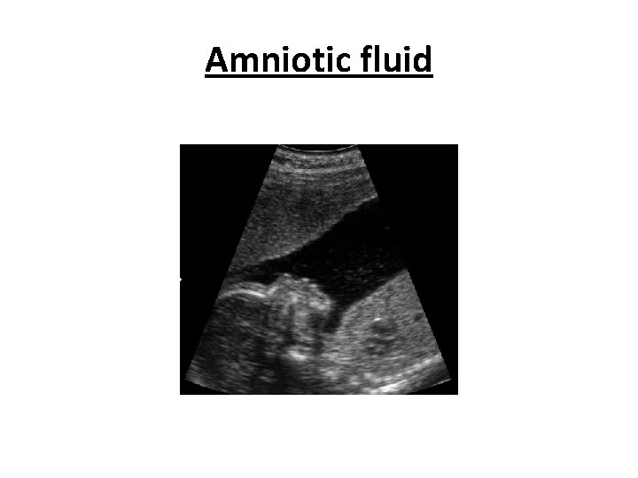 Amniotic fluid 
