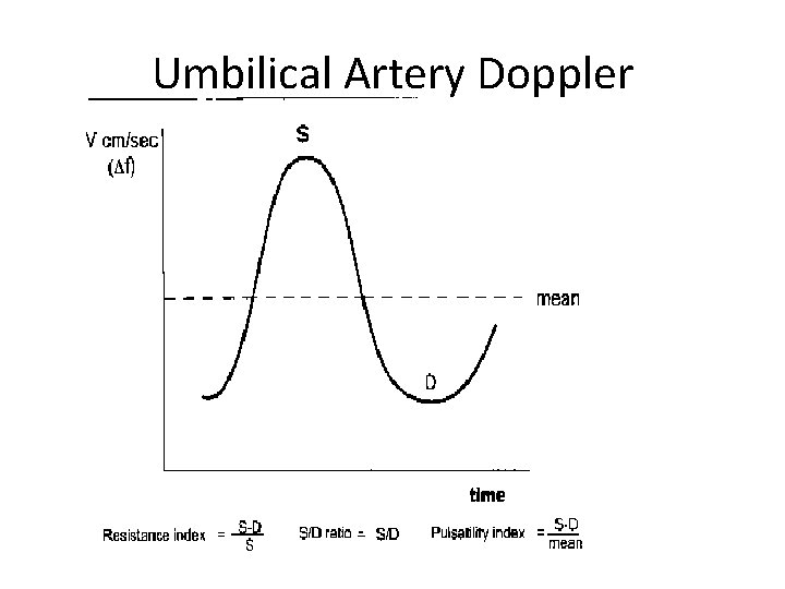 Umbilical Artery Doppler 