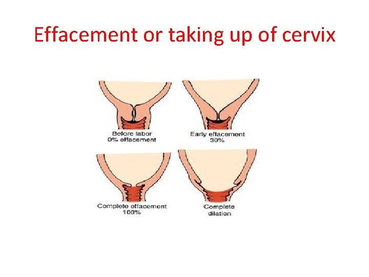 Effacement or taking up of cervix 