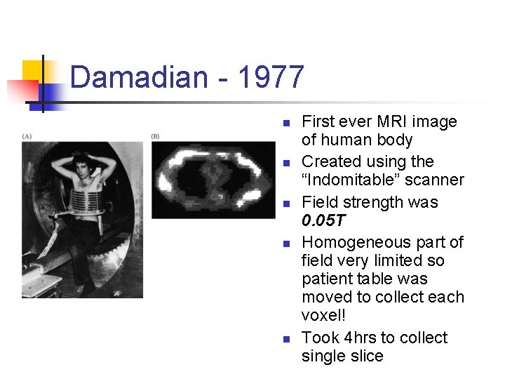 Damadian - 1977 n n n First ever MRI image of human body Created