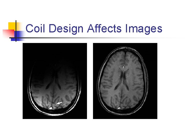 Coil Design Affects Images 