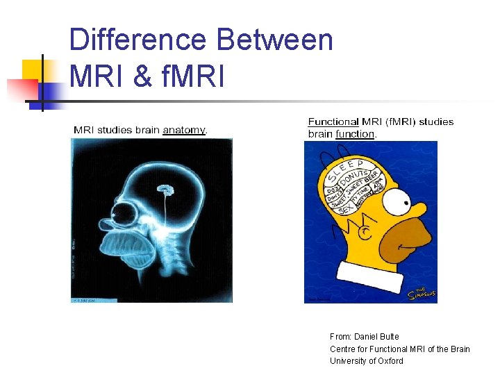 Difference Between MRI & f. MRI From: Daniel Bulte Centre for Functional MRI of