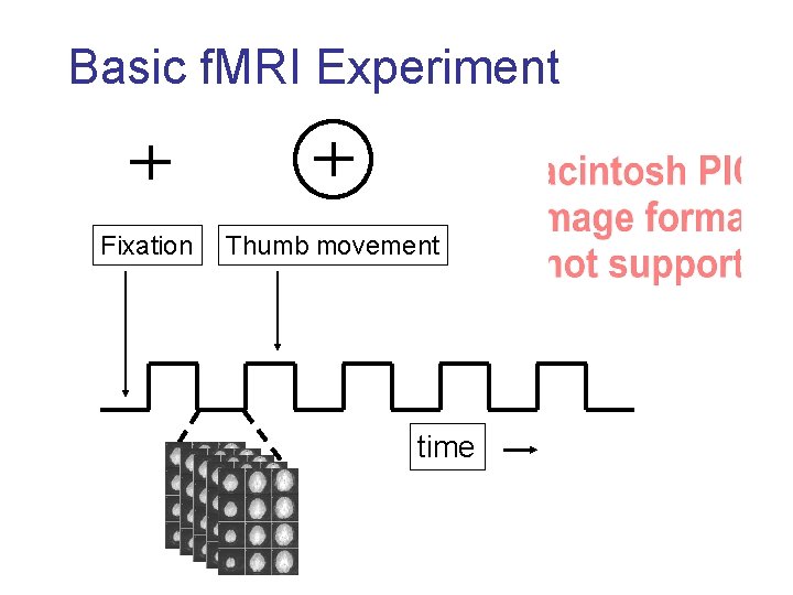 Basic f. MRI Experiment Fixation Thumb movement time 