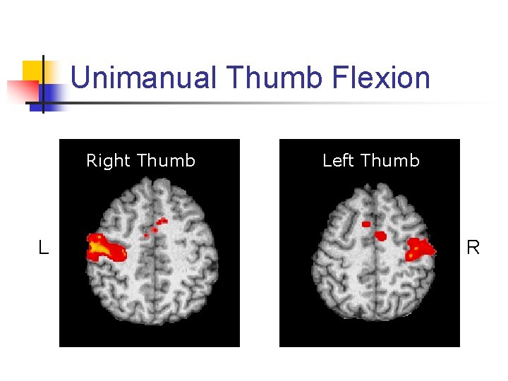 Unimanual Thumb Flexion Right Thumb L Left Thumb R 