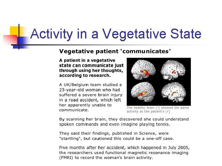 Activity in a Vegetative State 