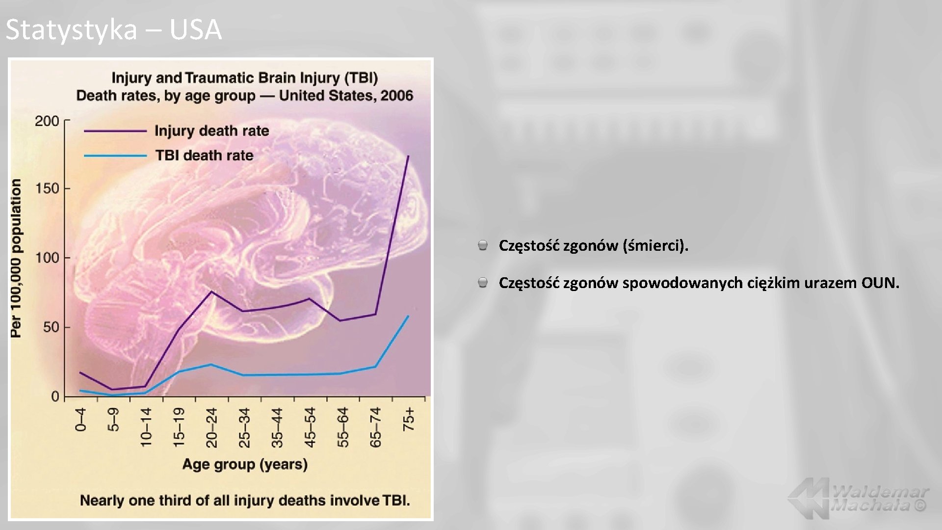 Statystyka – USA Częstość zgonów (śmierci). Częstość zgonów spowodowanych ciężkim urazem OUN. 