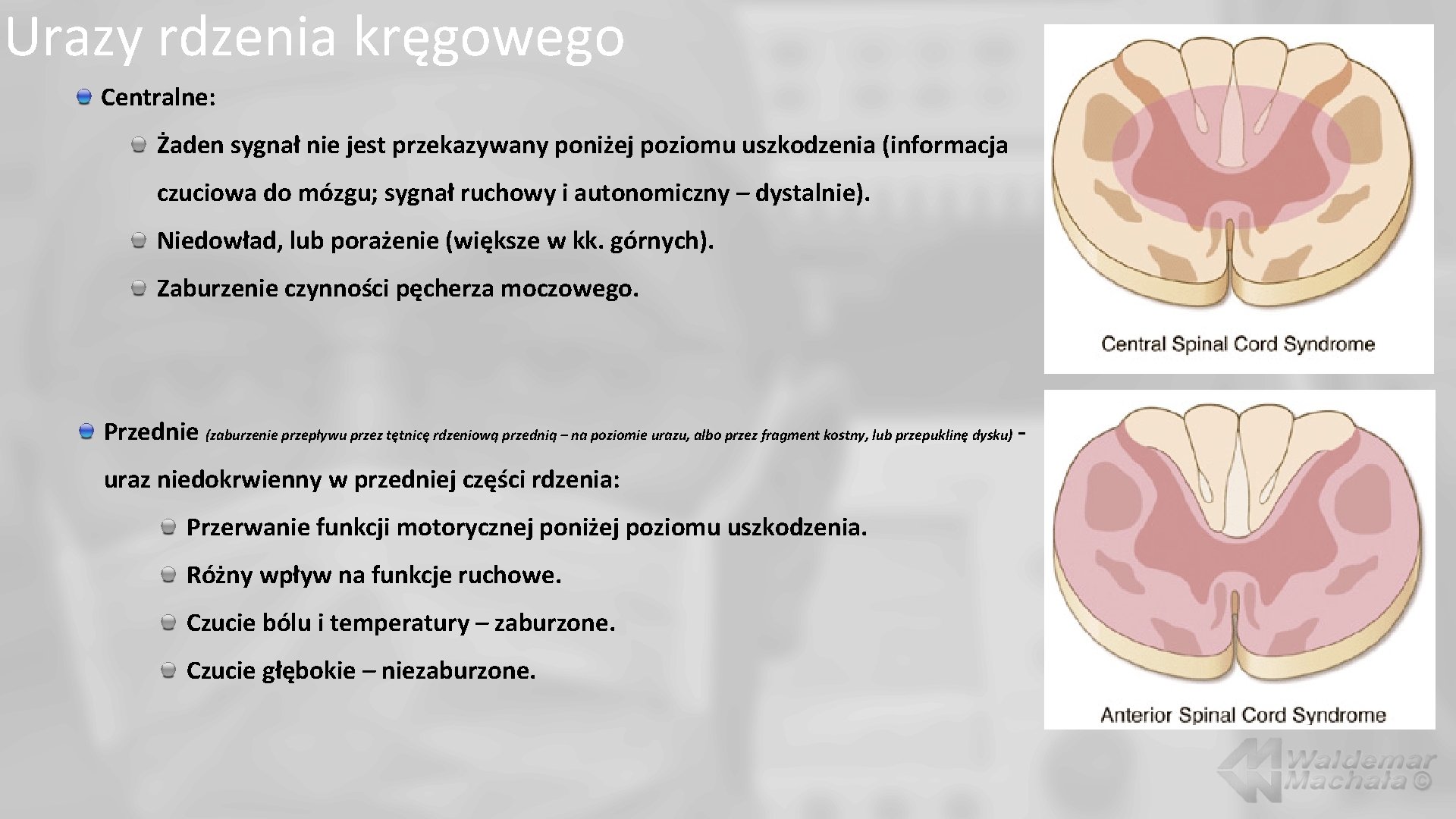 Urazy rdzenia kręgowego Centralne: Żaden sygnał nie jest przekazywany poniżej poziomu uszkodzenia (informacja czuciowa