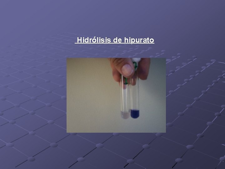 Hidrólisis de hipurato 