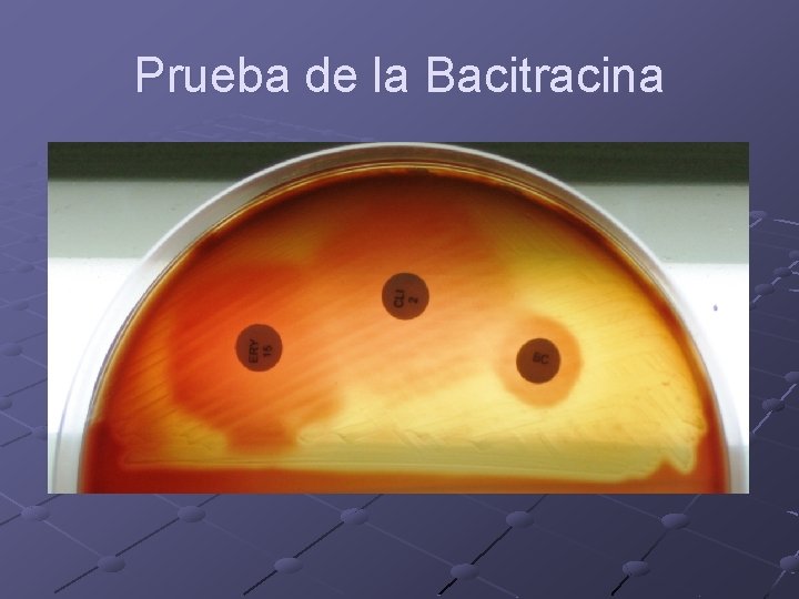 Prueba de la Bacitracina 