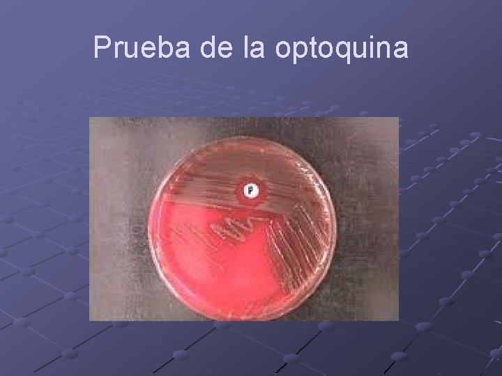 Prueba de la optoquina 