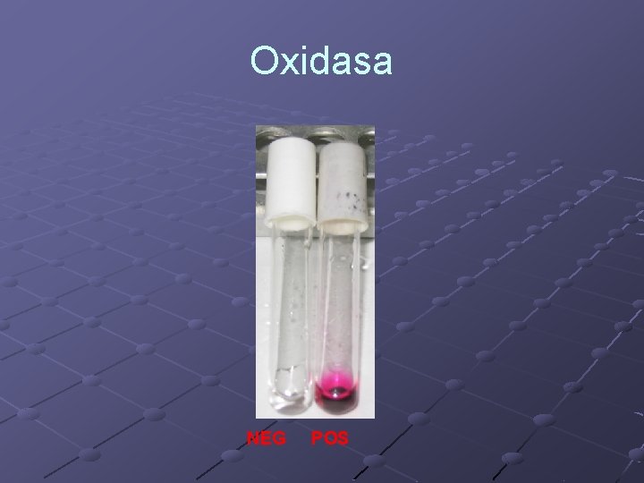 Oxidasa NEG POS 