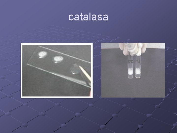 catalasa 