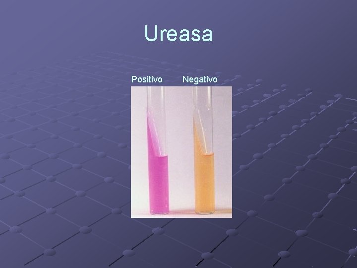 Ureasa Positivo Negativo 