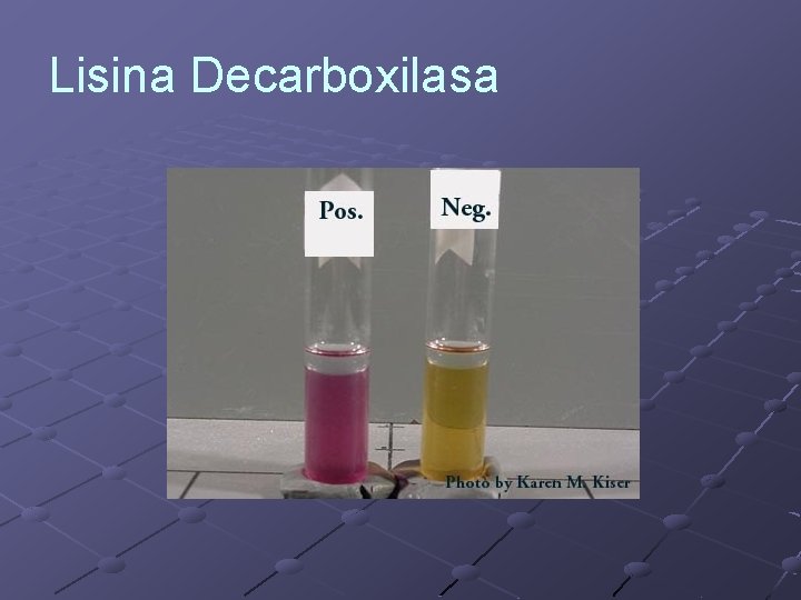Lisina Decarboxilasa 