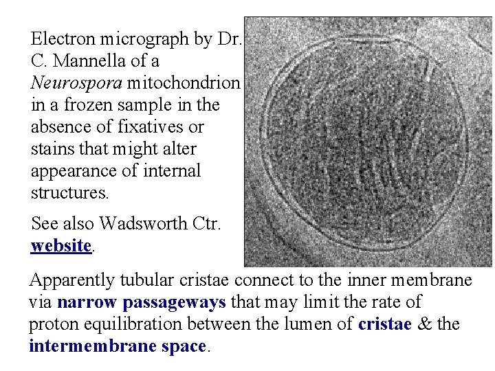 Electron micrograph by Dr. C. Mannella of a Neurospora mitochondrion in a frozen sample