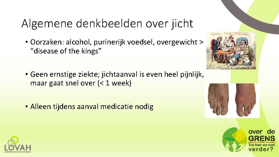 Algemene denkbeelden over jicht • Oorzaken: alcohol, purinerijk voedsel, overgewicht > “disease of the