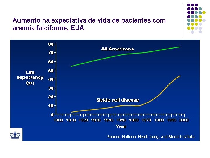 Aumento na expectativa de vida de pacientes com anemia falciforme, EUA. 