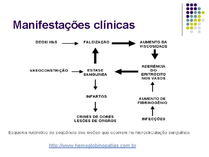 Manifestações clínicas http: //www. hemoglobinopatias. com. br 