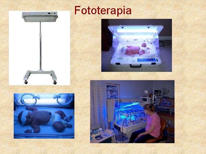 Fototerapia 