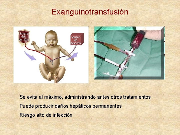 Exanguinotransfusión Se evita al máximo, administrando antes otros tratamientos Puede producir daños hepáticos permanentes