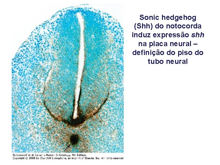 Sonic hedgehog (Shh) do notocorda induz expressão shh na placa neural – definição do