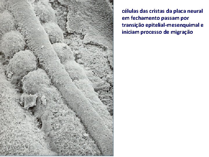 células das cristas da placa neural em fechamento passam por transição epitelial-mesenquimal e iniciam