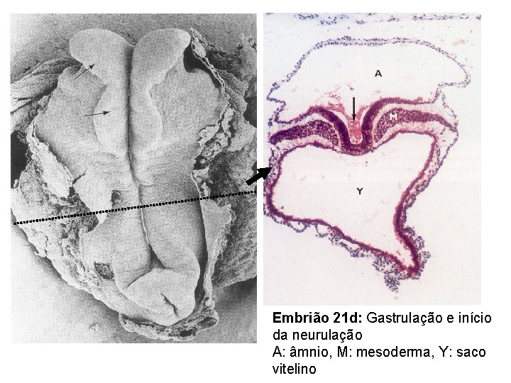 Embrião 21 d: Gastrulação e início da neurulação A: âmnio, M: mesoderma, Y: saco