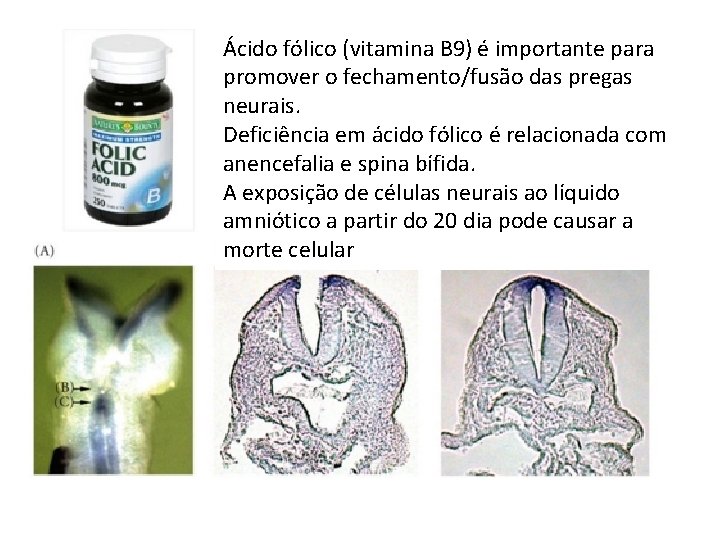 Ácido fólico (vitamina B 9) é importante para promover o fechamento/fusão das pregas neurais.
