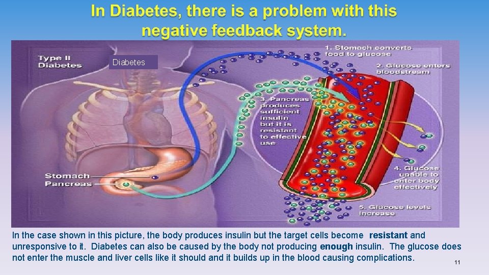 Diabetes In the case shown in this picture, the body produces insulin but the