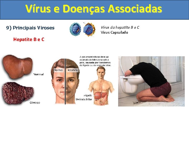 Vírus e Doenças Associadas 9) Principais Viroses Hepatite B e C Vírus da hepatite