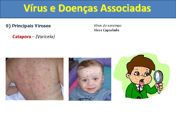 Vírus e Doenças Associadas 9) Principais Viroses Catapora – (Varicela) Vírus do sarampo Vírus