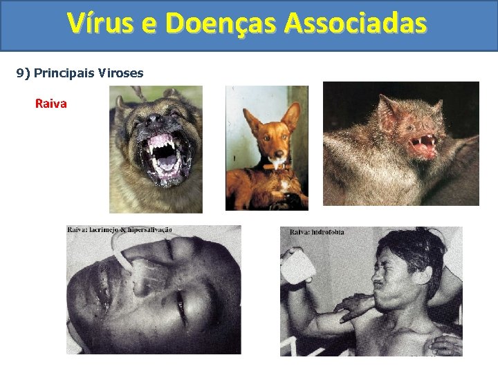 Vírus e Doenças Associadas 9) Principais Viroses Raiva 
