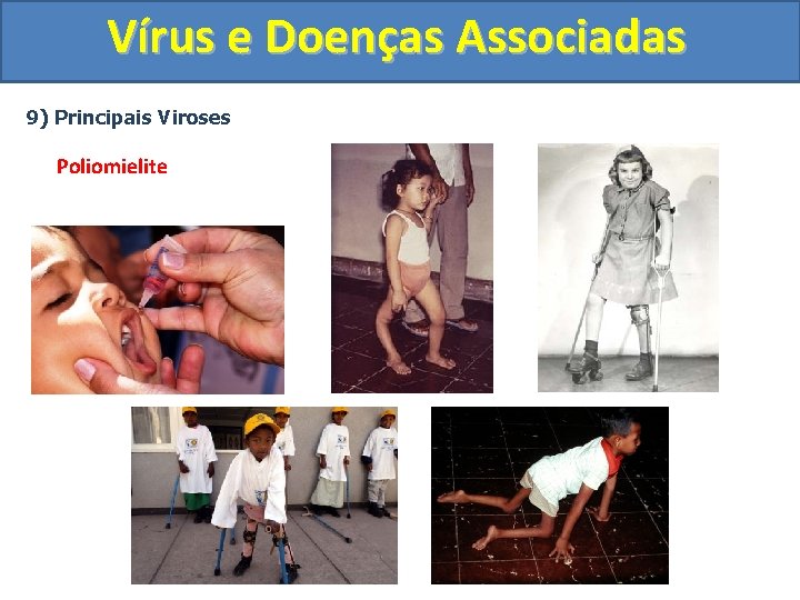 Vírus e Doenças Associadas 9) Principais Viroses Poliomielite 