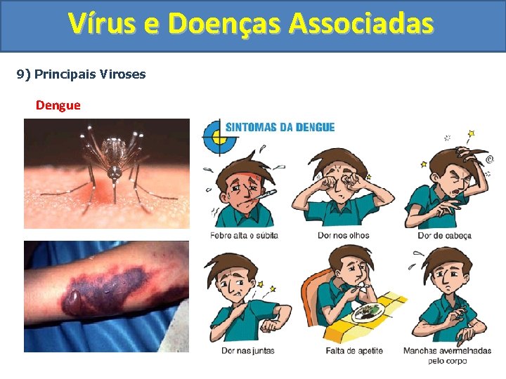 Vírus e Doenças Associadas 9) Principais Viroses Dengue 