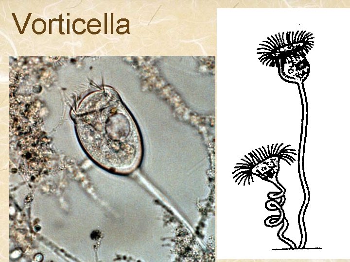 Vorticella 